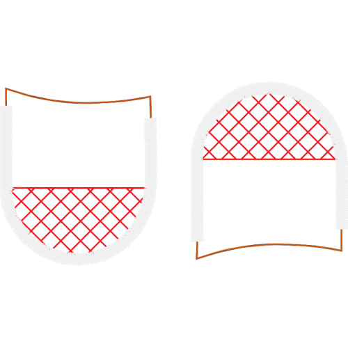 Antenna Other Antenna Other