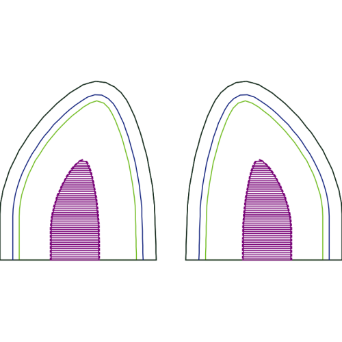 Arch Other Arch Other