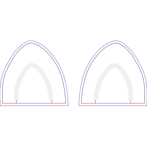 Arch Other Arch Other
