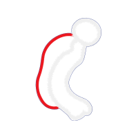 Graphic Other