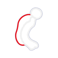 Graphic Other