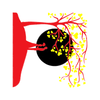 Graphic Other