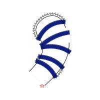 M 02Csf Other