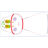 M 02Csf Other