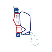 M 02Csf Other