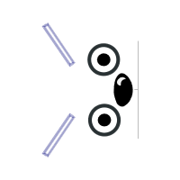 M 02Csf Other