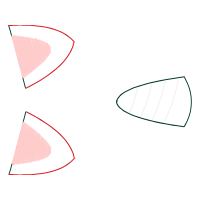 M 02Csf Other