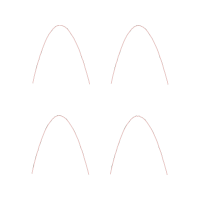 M 02Csf Other