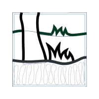 Meter Other