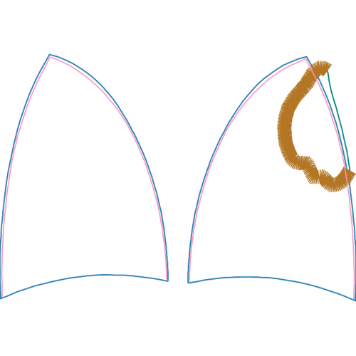 Recreation Other Recreation Other