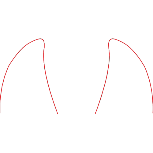 Site A Other Site A Other