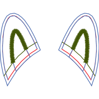 Triangle Other Triangle Other