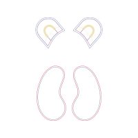 Meter Wedding Meter Wedding